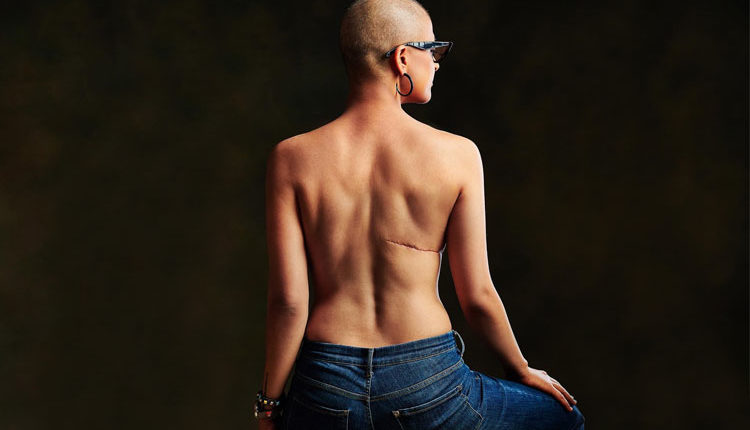 World Cancer Day